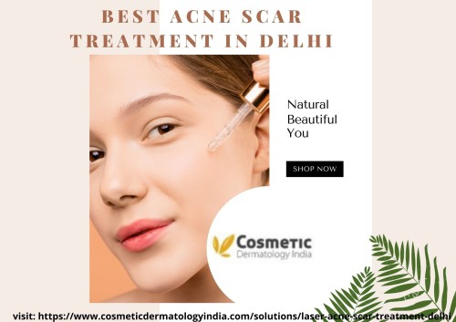 Best-Acne-Scar-Treatment-In-Delhi.jpg