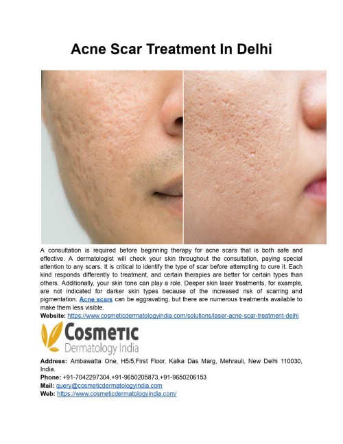 Acne-Scar-Treatment-In-Delhi-cosmeticdermatology.jpg