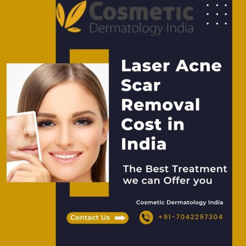 Anyone who has dealt with acne knows that the social consequences of having this skin condition can be devastating. It leaves you with unsightly scars, especially if you have severe acne or pimples. Cosmetic Dermatology India is one of the best Laser Acne Scar Removal Cost in India. Our packages and treatments are among the best in the market. For more information, please visit our website.
Link: https://www.cosmeticdermatologyindia.com/solutions/laser-acne-scar-treatment-delhi