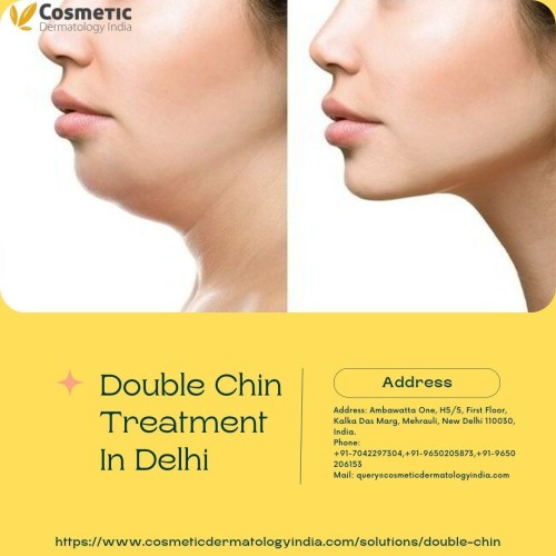 At Cosmetic Dermatology India, we provide a variety of double chin removal treatments in Delhi, such as Kybella and SculpSure, which are designed to treat stubborn fat and sagging skin that contribute to a double chin.
https://www.cosmeticdermatologyindia.com/solutions/double-chin