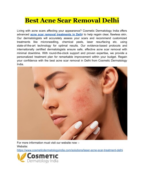 Cosmetic Dermatology India provides innovative acne scar removal treatments in Delhi that use time-tested techniques to provide outstanding results within your budget.
Website: https://www.cosmeticdermatologyindia.com/solutions/laser-acne-scar-treatment-delhi
