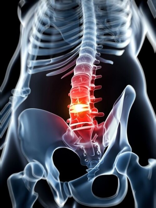 If you are looking for herniated disk treatment that deals with the prevention and diagnosis, make sure you are approaching the best Neurosurgeon. At Total Spine & Brain Institute, you can find one. Please visit the website for more details! Visit: https://totalspinebrain.com/herniated-disk-or-bulging-disk/